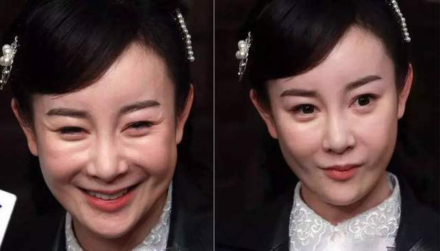 娱乐圈没整过容的明星_孙菲菲整容后无戏可拍_娱乐圈整容女明星名单