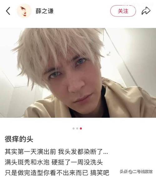 男明星脱发前后对照图_脱发男星圈娱乐女明星_娱乐圈脱发的男星